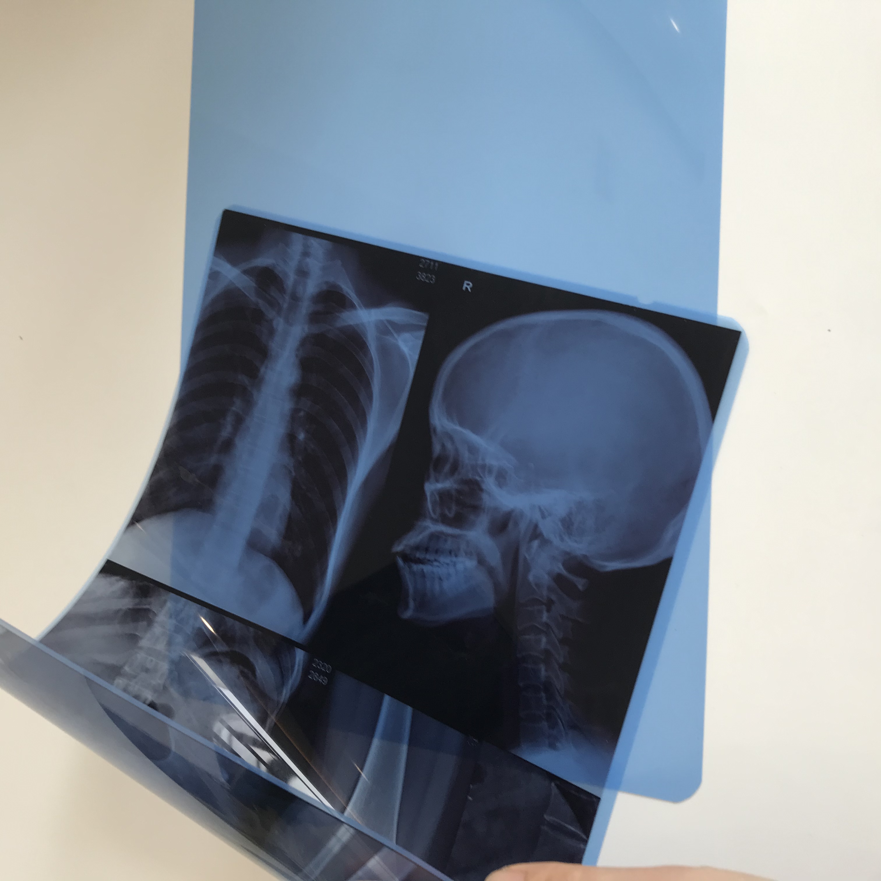 Venta al por mayor para película de rayos X médica de inyección de tinta PET con base azul universal 175um