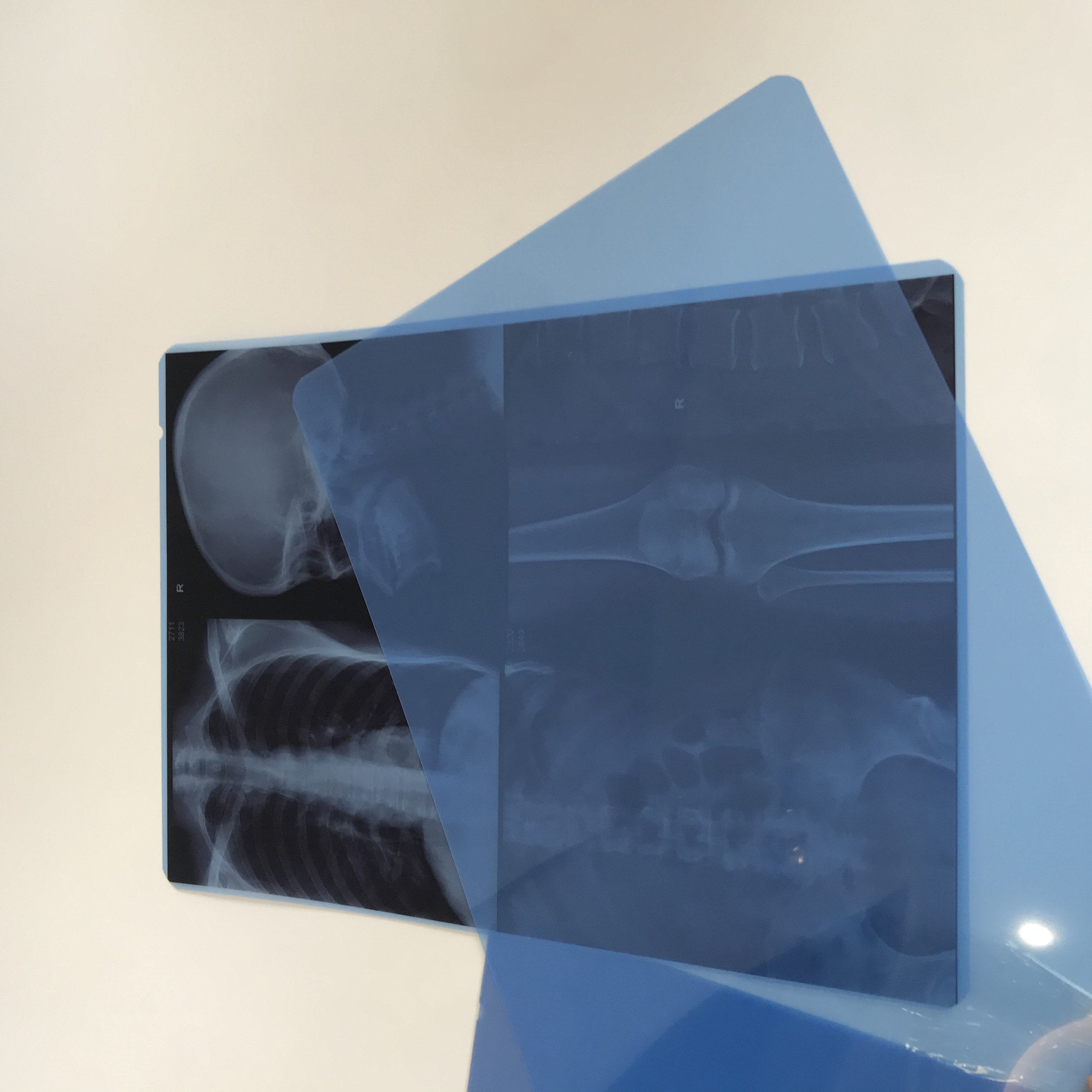 Película médica del bf de la radiografía del chorro de tinta del color azul seco
